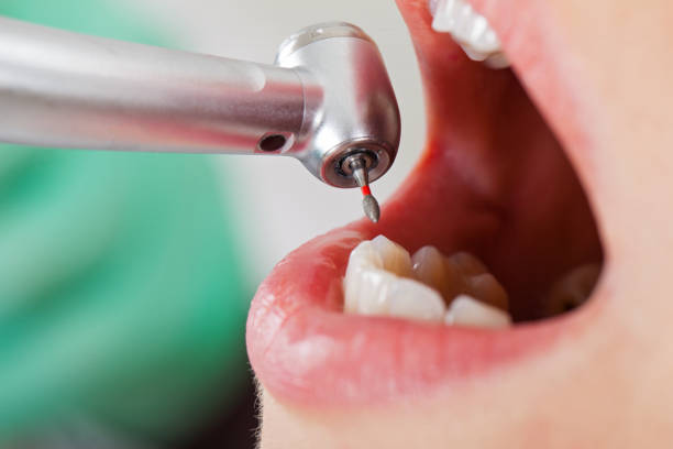 Best Walk-In Emergency Dental Services in Carencro, LA